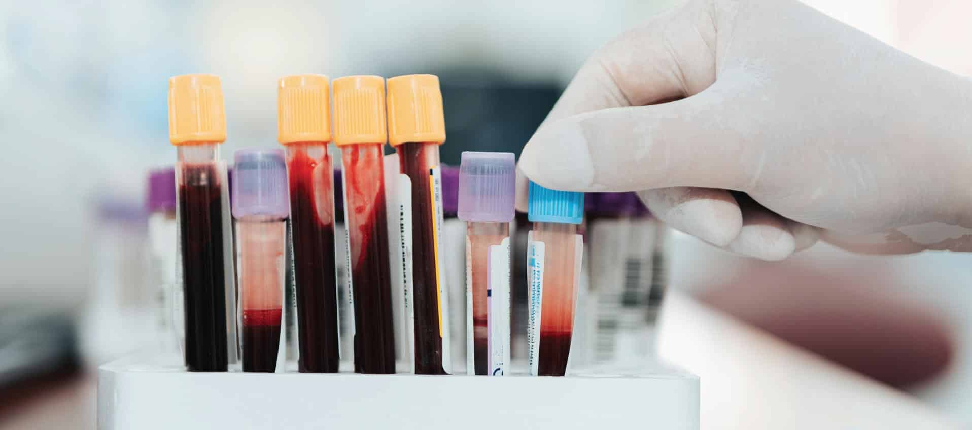 Advanced STD screening laboratory equipment at Priority ER Odessa Texas emergency room