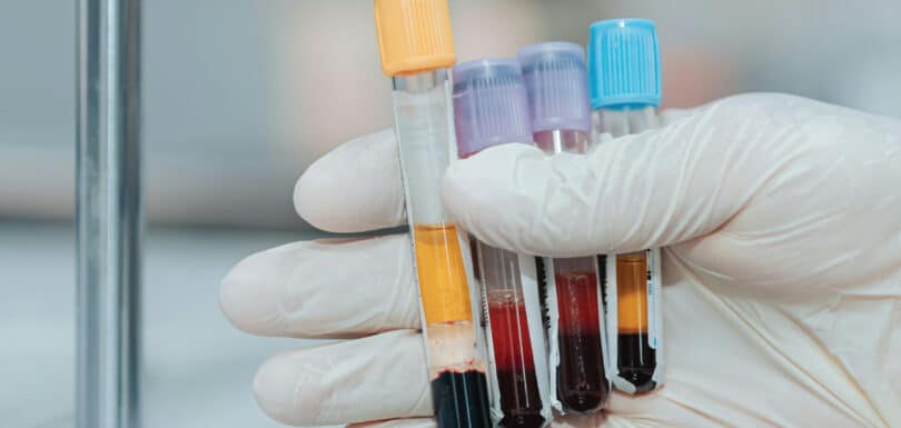 Blood test at urgent care laboratory equipment Odessa Texas emergency room