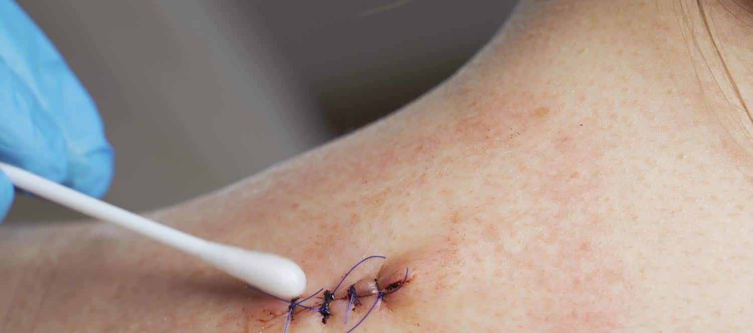 Advanced Wound Care Treatment Area at Priority ER Odessa Does urgent care do stitches emergency wound treatment room Odessa Texas