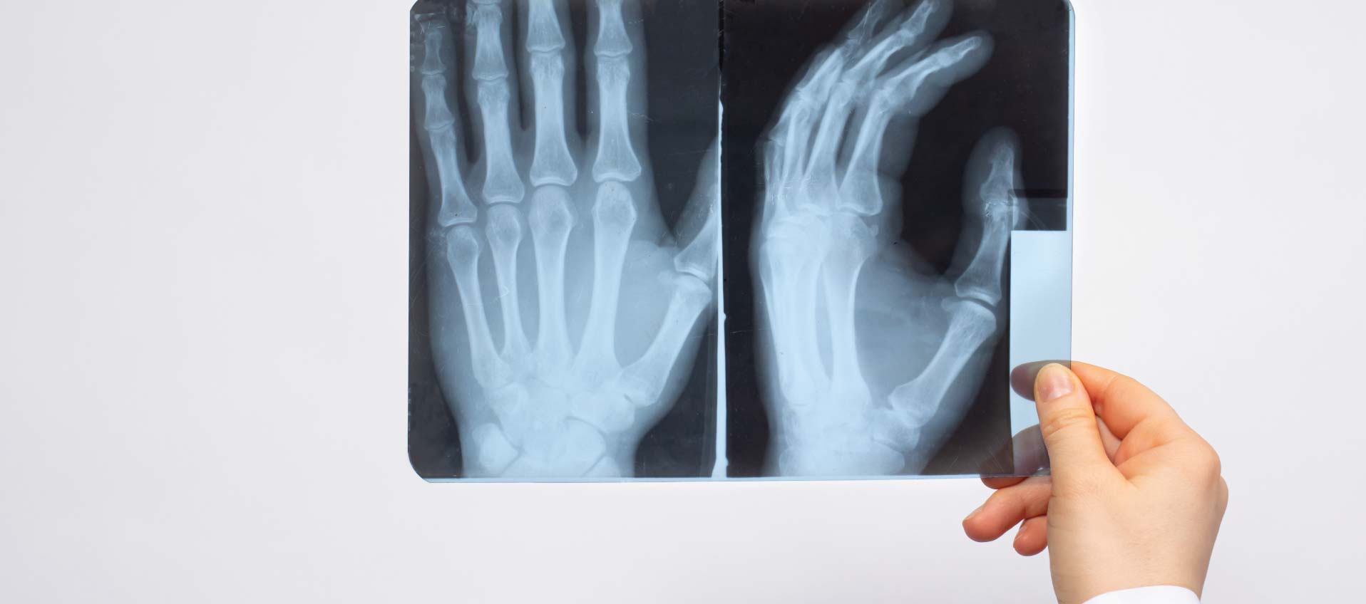 Urgent care or emergency room for broken bone digital X-ray technology Odessa Texas