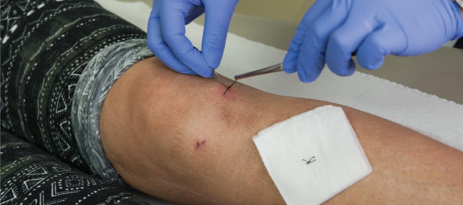 Specialized Wound Repair Instruments at Priority ER Odessa Texas Advanced wound closure techniques emergency room Odessa Texas