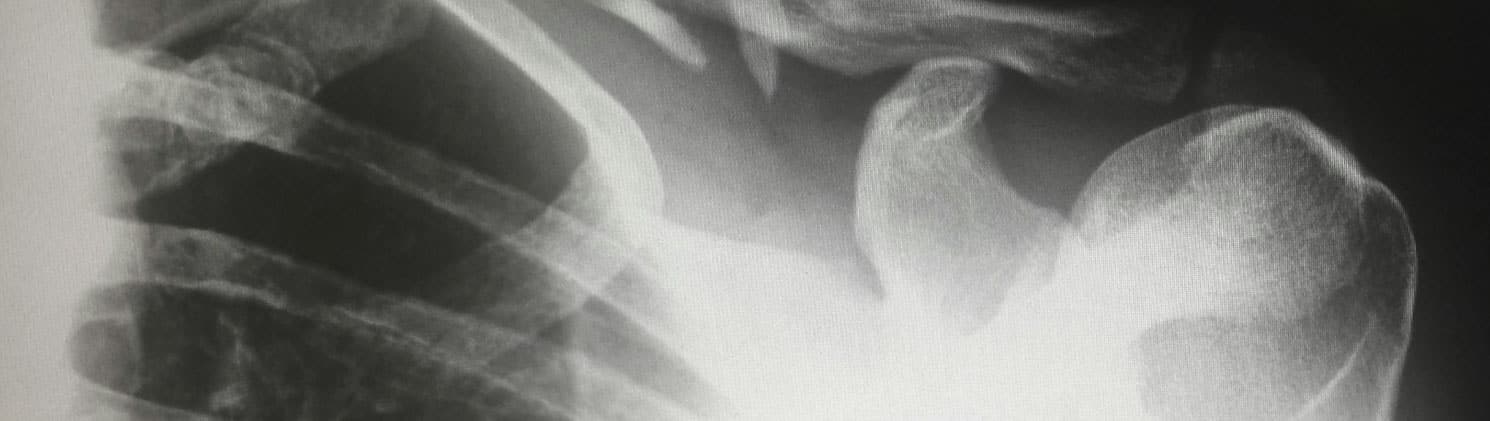 Immediate X-Ray Results Review at Priority ER Near You in Odessa Texas Digital X-ray results viewing station near me Odessa Texas
