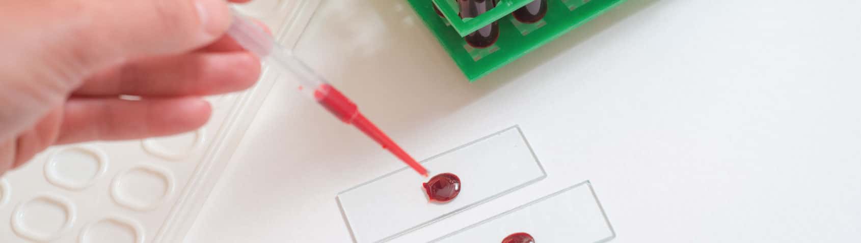 Confidential Result Consultation at Priority ER Odessa Texas Private consultation room STD testing results Odessa Texas