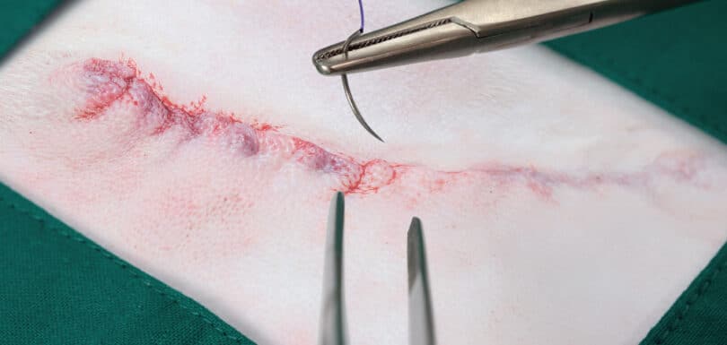 ER or urgent care for stitches wound care facility comparison Odessa Texas emergency room