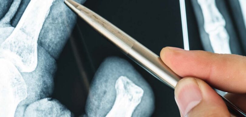 Urgent care or emergency room for broken bone X-ray evaluation Odessa Texas Priority ER