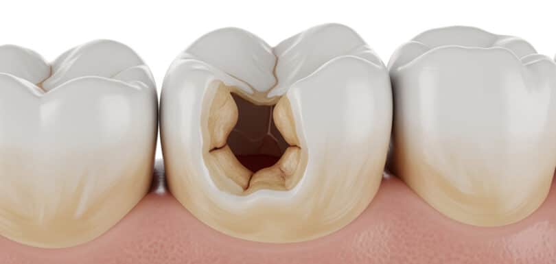 Can emergency room help with tooth pain dental emergency treatment evaluation Odessa Texas