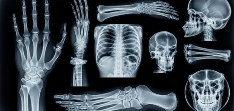 Emergency x-ray services diagnostic imaging equipment and radiology analysis Odessa Texas emergency room