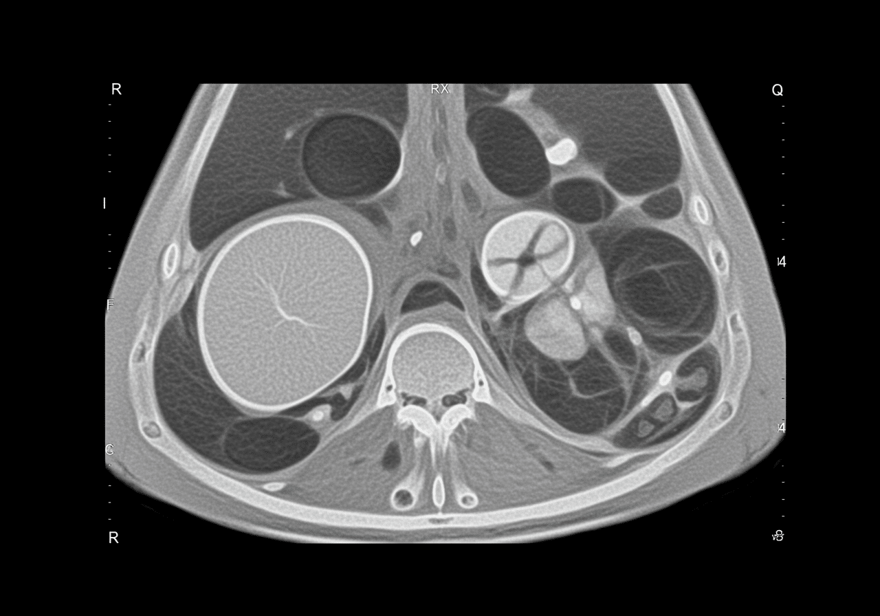 Emergency physician reviewing abdominal CT scan at Priority ER