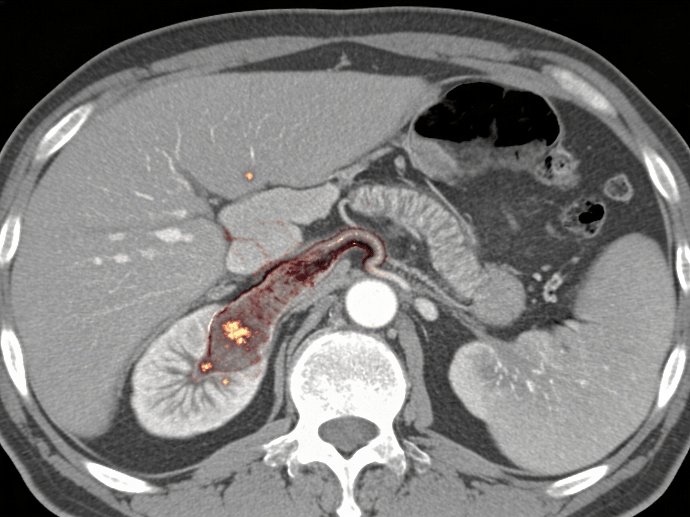 Nutritionist educating about high-fiber diet for appendicitis prevention