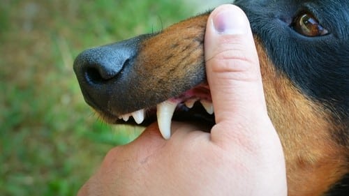 Emergency physician administering rabies post-exposure prophylaxis for animal and human bites at Priority ER