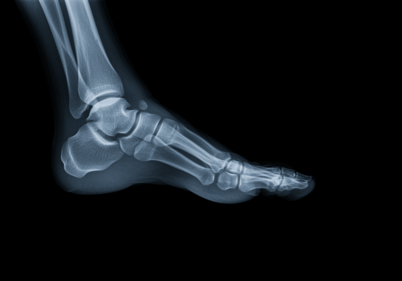 Oil field workers receiving ankle safety training and proper footwear