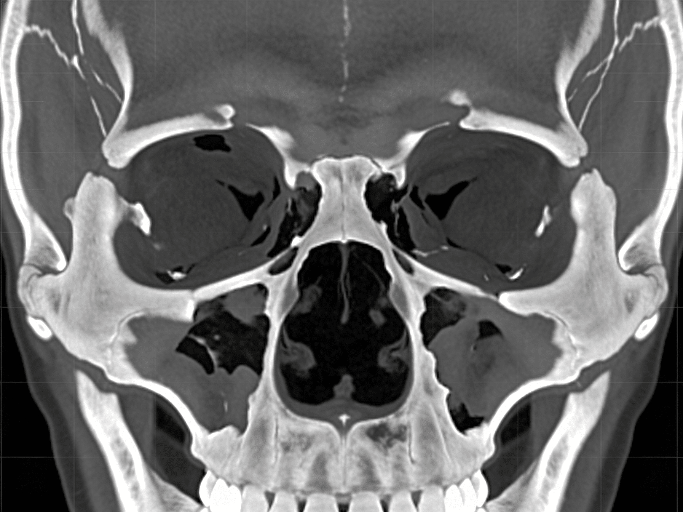 Emergency responders demonstrating vehicle safety and fracture prevention