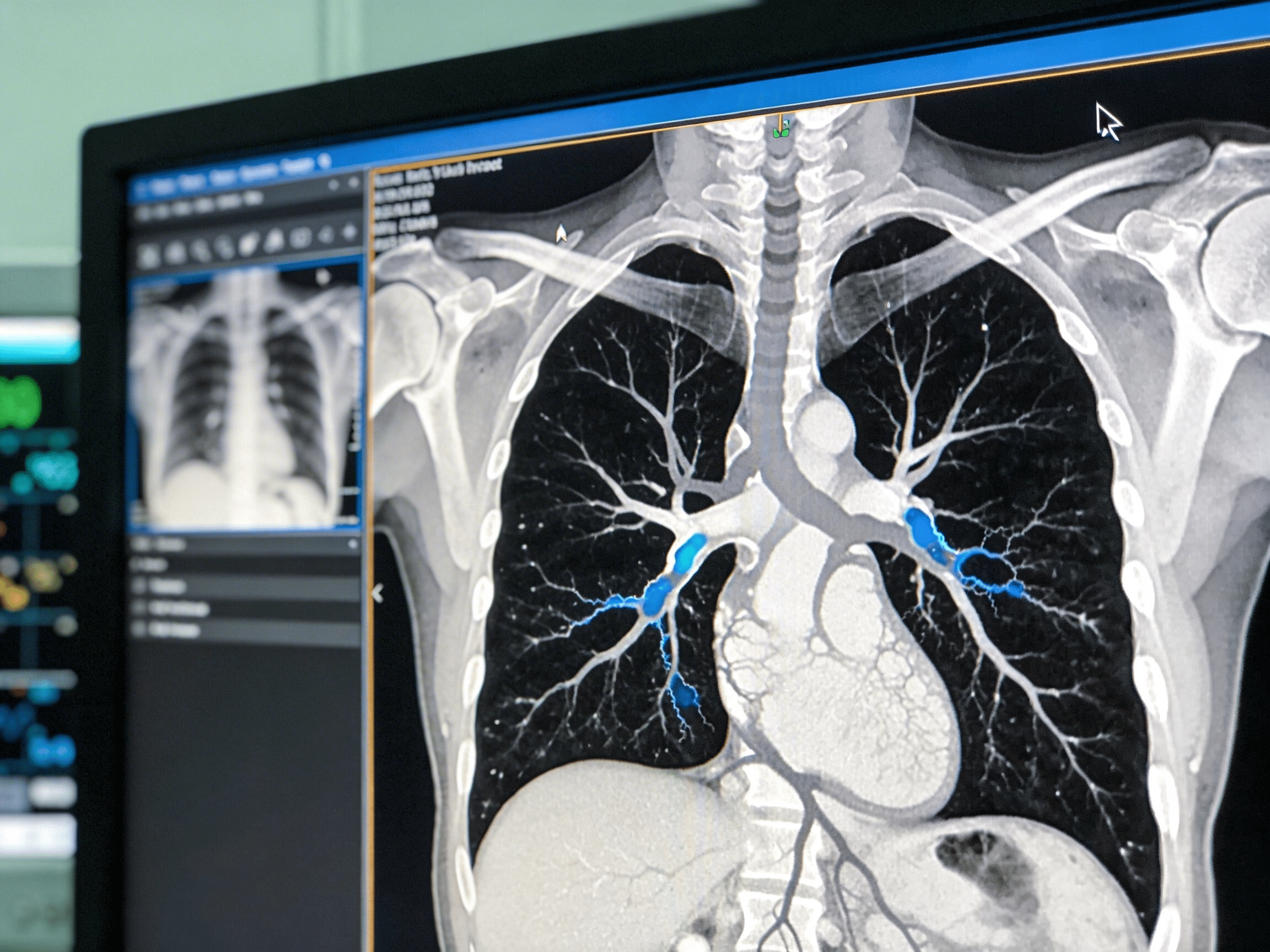 Emergency physician reviewing chest X-ray and CT angiogram at Priority ER