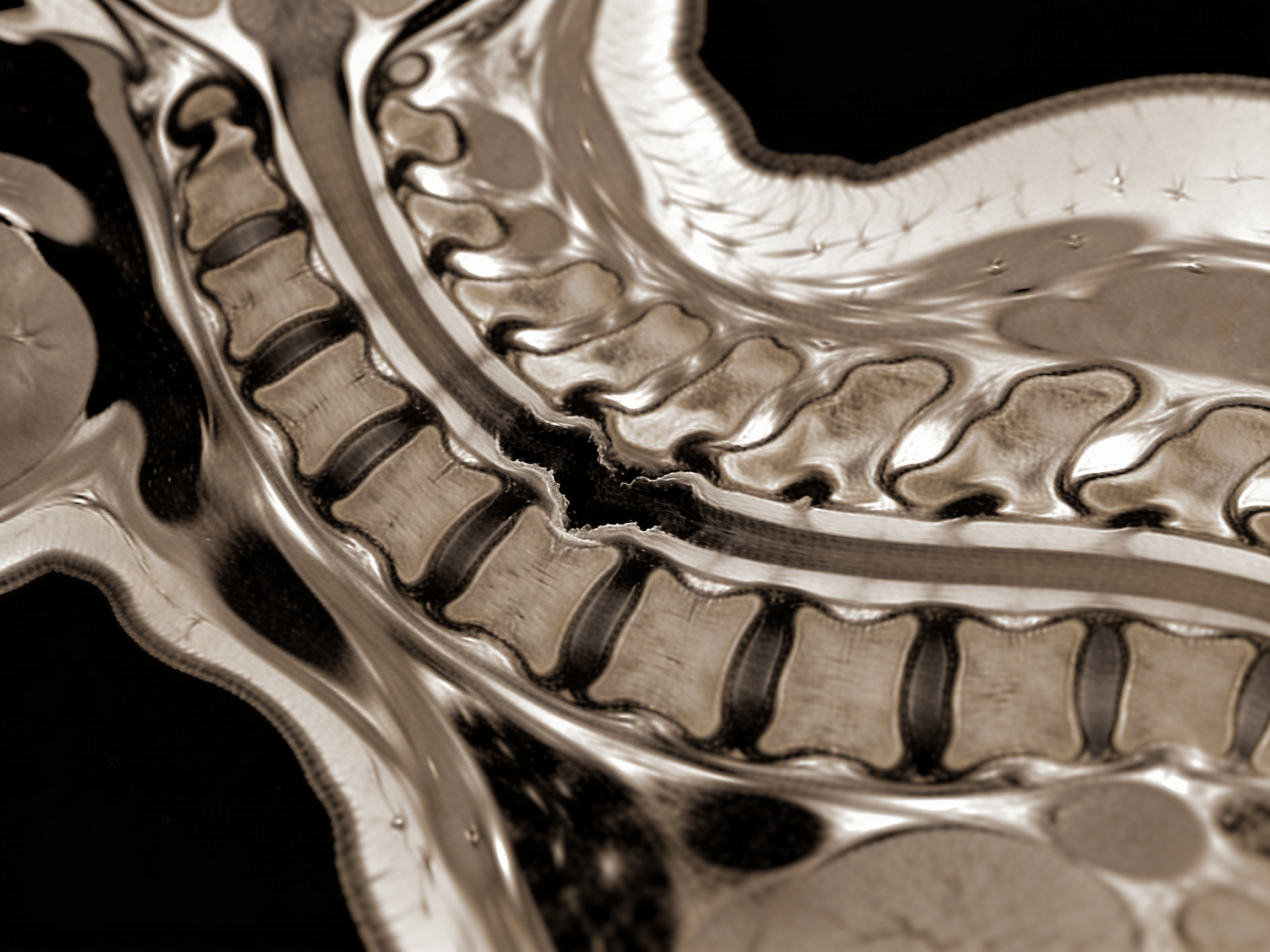 Oil field workers receiving spinal injury prevention and safety training
