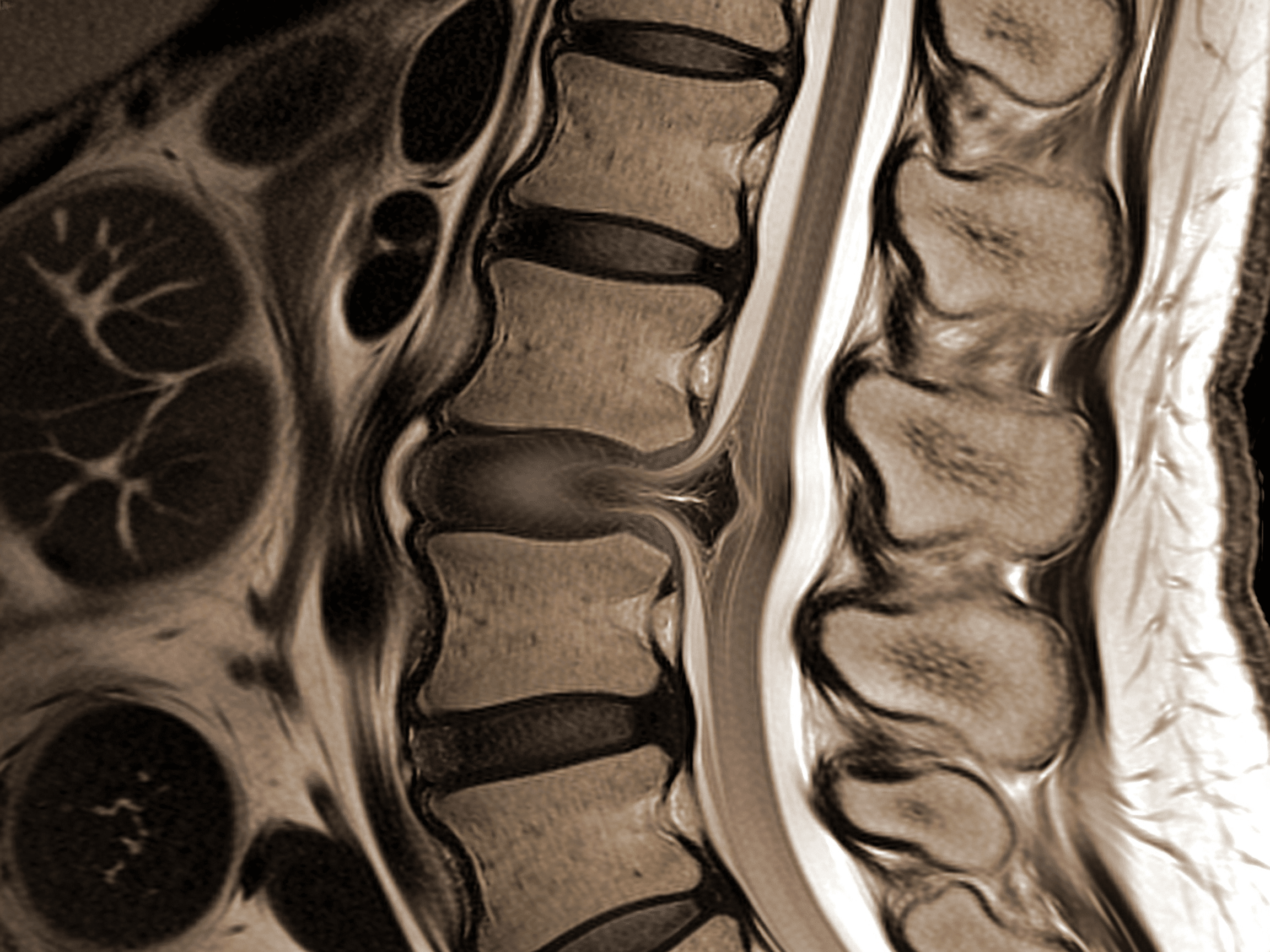 Priority ER neurosurgery consultation team reviewing MRI spine images