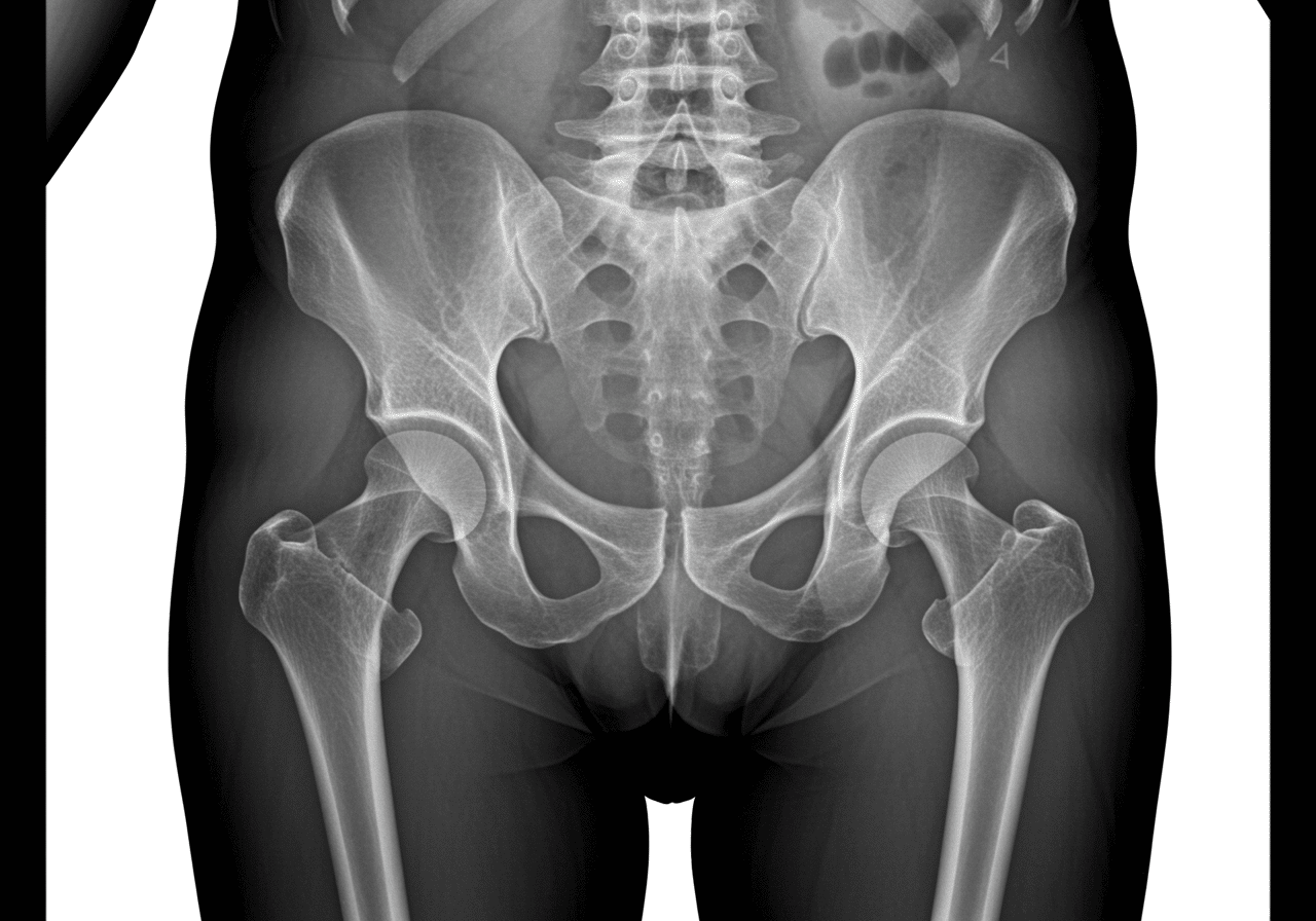 Emergency hip fracture trauma room at Priority ER Odessa with specialized equipment