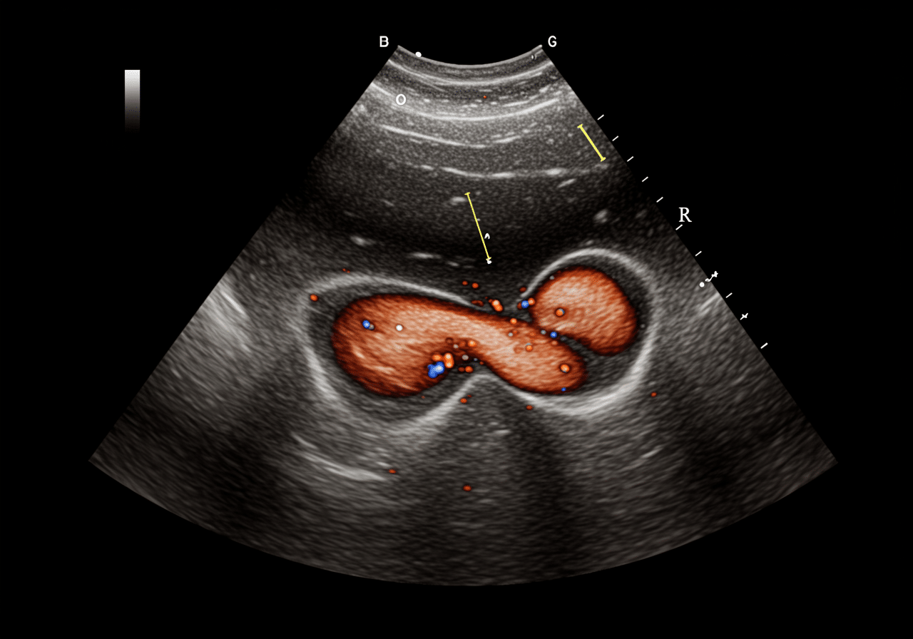 Emergency pelvic ultrasound room at Priority ER Odessa with advanced equipment