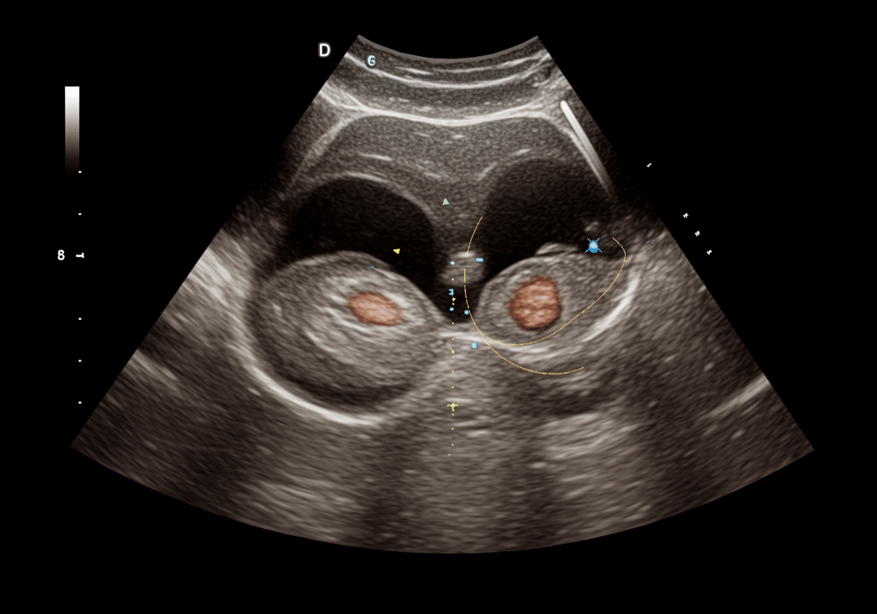 Priority ER facility exterior in Odessa Texas showing 24/7 emergency entrance