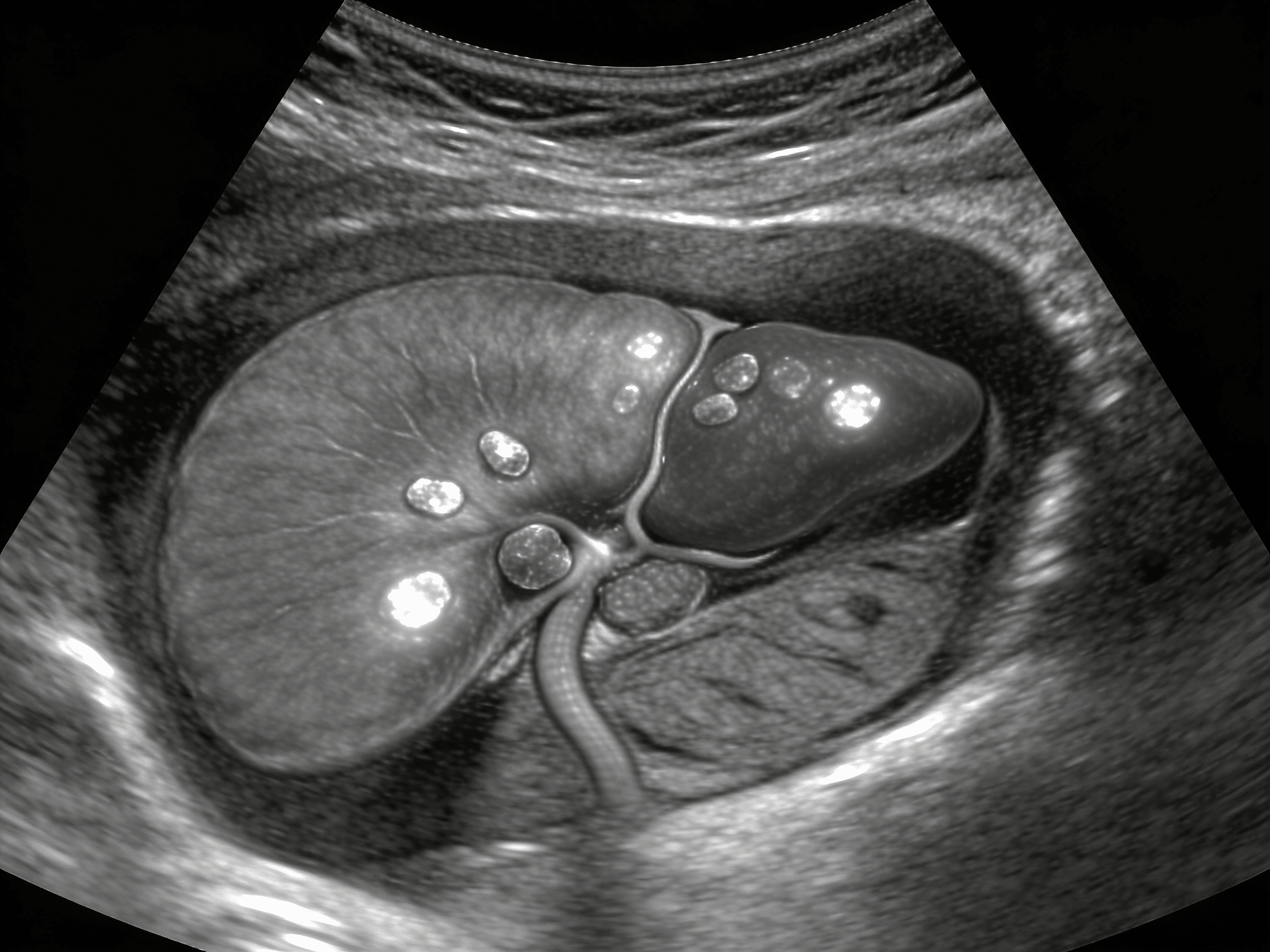 Emergency ultrasound room at Priority ER Odessa with portable machines