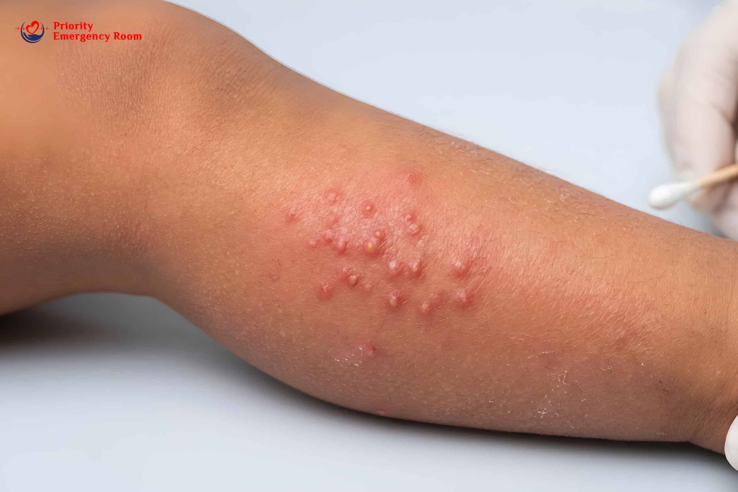 Spreading infection warning signs