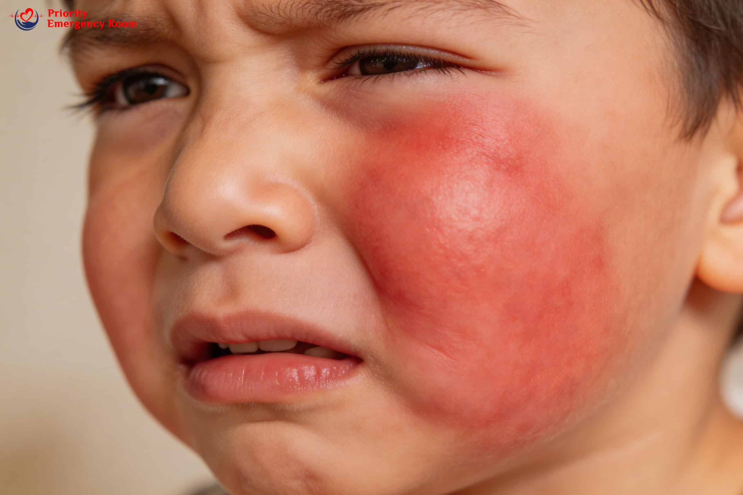 Child with fever from dental infection