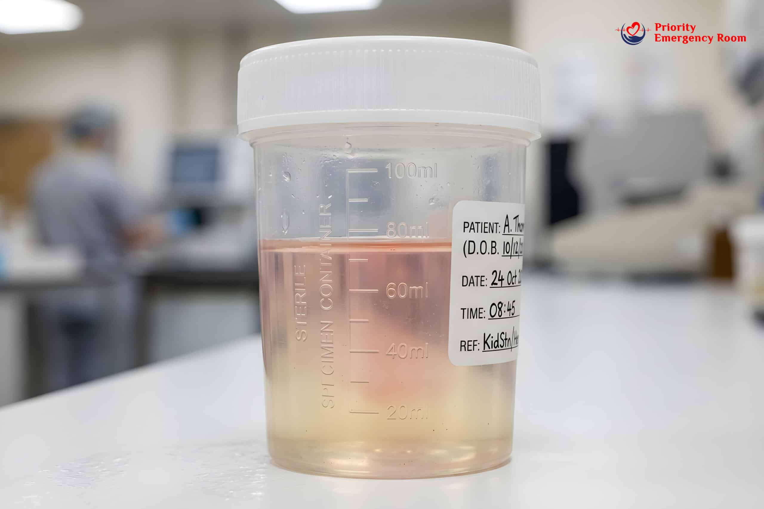 Blood in urine with kidney stone pain - ER visit needed