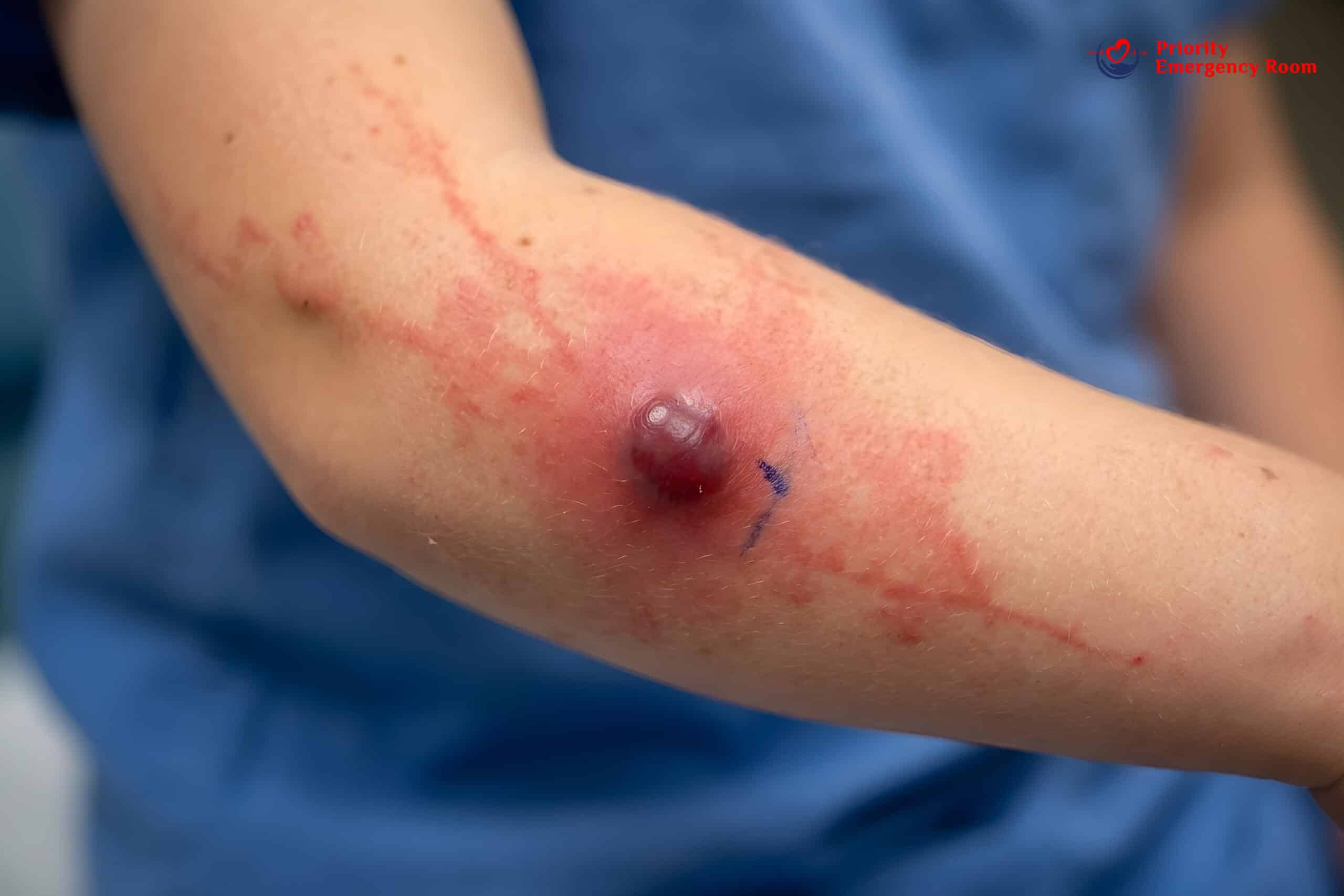 Medical examination for cyst on face or neck