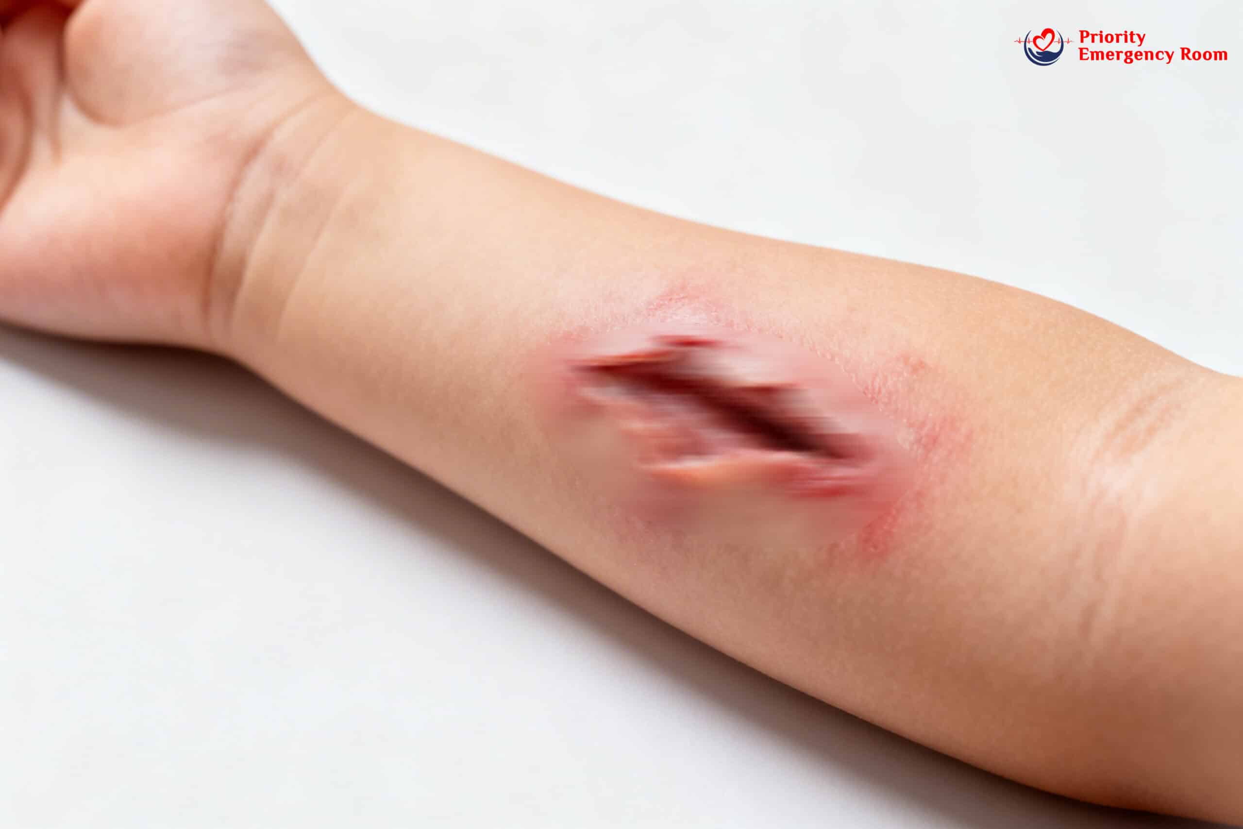 Facial laceration requiring specialized care